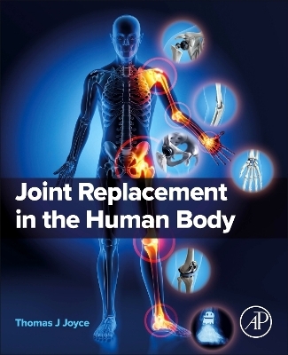 Joint Replacement in the Human Body - Thomas J Joyce
