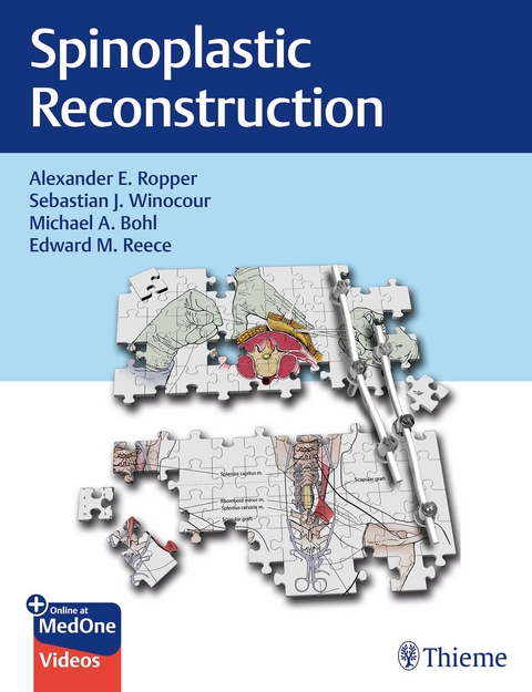 Spinoplastic Reconstruction - Alexander Ropper, Sebastian Winocour, Michael Bohl, Edward Reece
