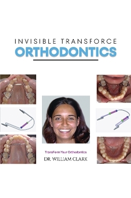 Invisible TransForce Orthodontics - Dr. William Clark