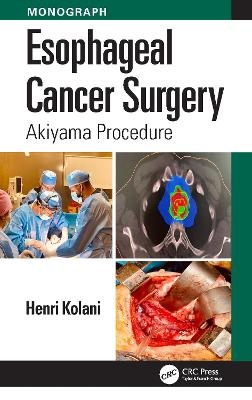 Esophageal Cancer Surgery - Henri Kolani