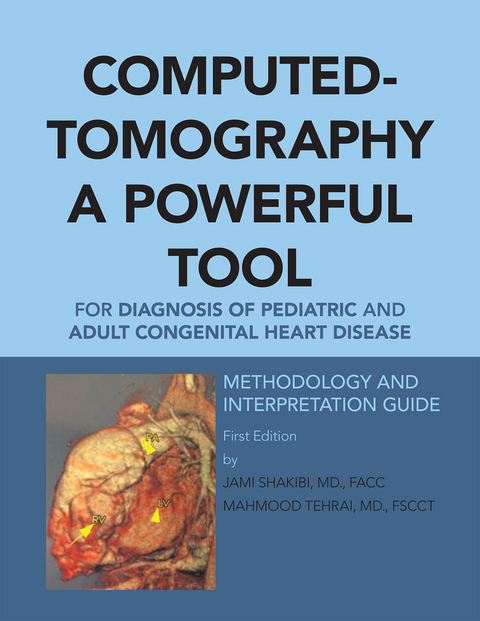 Computed-Tomography a Powerful Tool for Diagnosis of Pediatric and Adult Congenital Heart Disease -  Jami G. Shakibi
