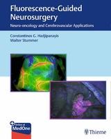 Fluorescence-Guided Neurosurgery - Constantinos G. Hadjipanayis, Walter Stummer