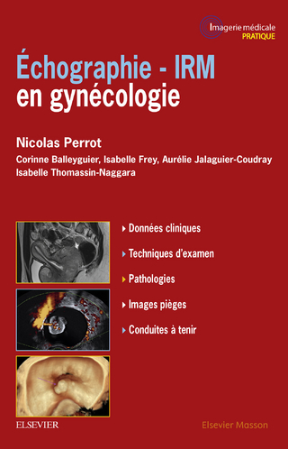 Echographie - IRM en gynécologie - Nicolas Perrot