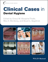 Clinical Cases in Dental Hygiene - 