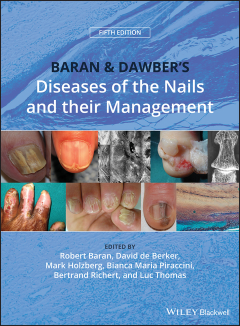 Baran and Dawber's Diseases of the Nails and their Management - 