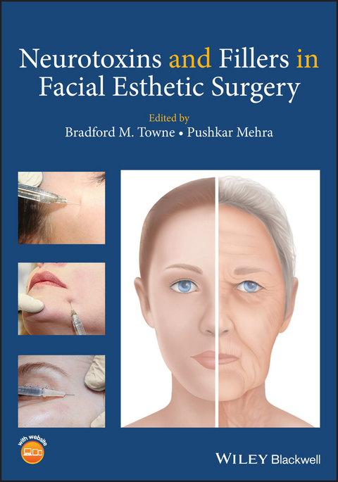 Neurotoxins and Fillers in Facial Esthetic Surgery - 