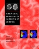 Magnetic Resonance Imaging in Stroke - Stephen Davis; Marc Fisher; Steven Warach