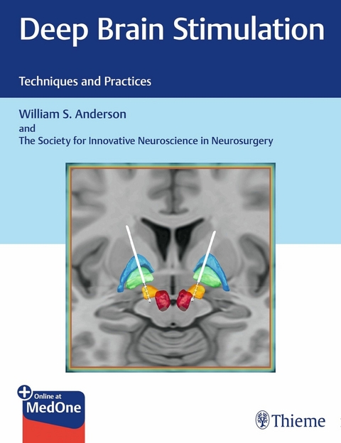 Deep Brain Stimulation - William S. Anderson,  The Society for Innovative Neuroscience