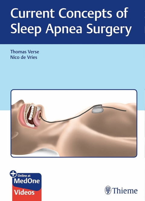 Current Concepts of Sleep Apnea Surgery - 