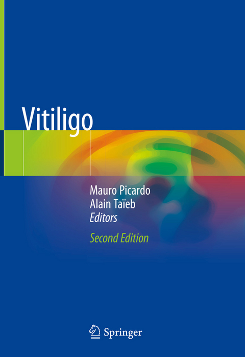 Vitiligo - 