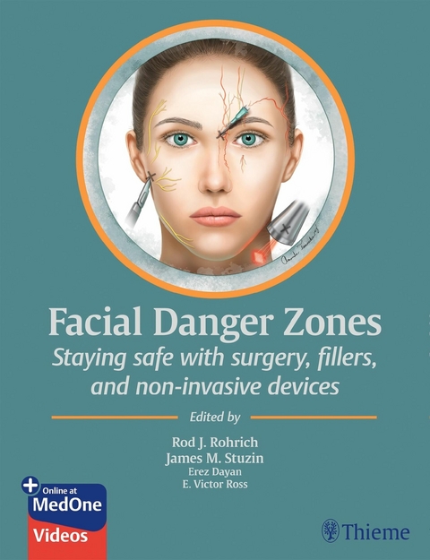 Facial Danger Zones - 