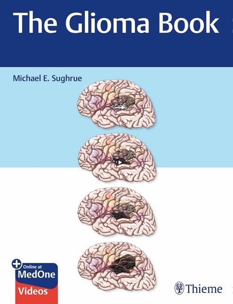 The Glioma Book - Michael E. Sughrue