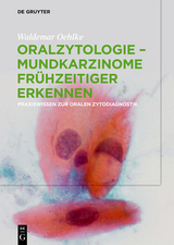 Oralzytologie - Mundkarzinome frühzeitiger erkennen -  Waldemar Oehlke