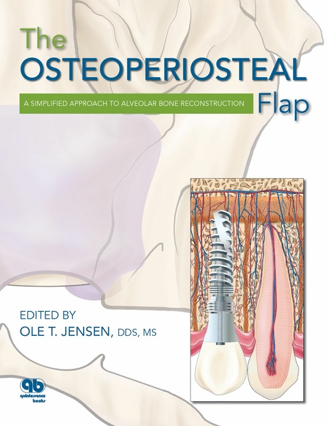 The Osteoperiosteal Flap - Ole T. Jensen