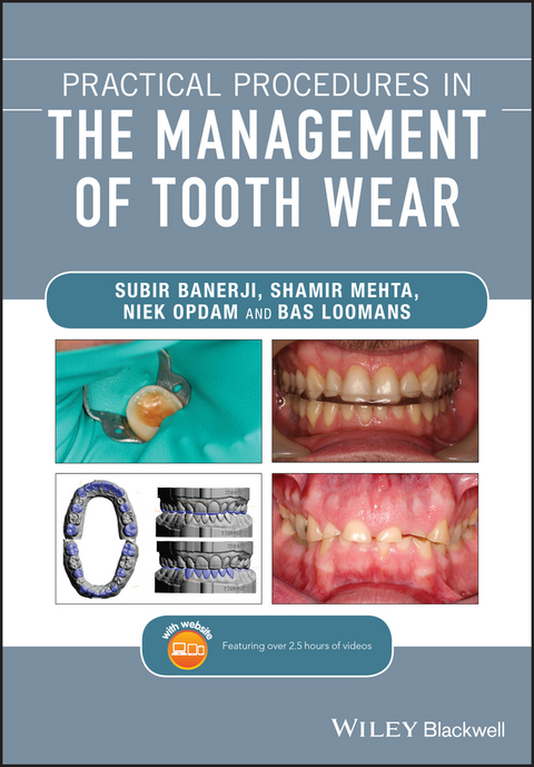 Practical Procedures in the Management of Tooth Wear -  Subir Banerji,  Bas Loomans,  Shamir B. Mehta,  Niek Opdam