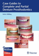 Case Guides to Complete and Partial Denture Prosthodontics - Robin Wilding