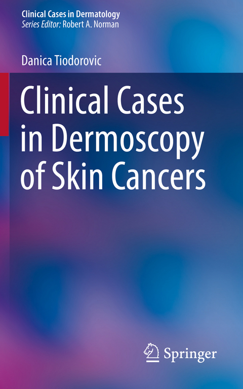 Clinical Cases in Dermoscopy of Skin Cancers -  Danica Tiodorovic