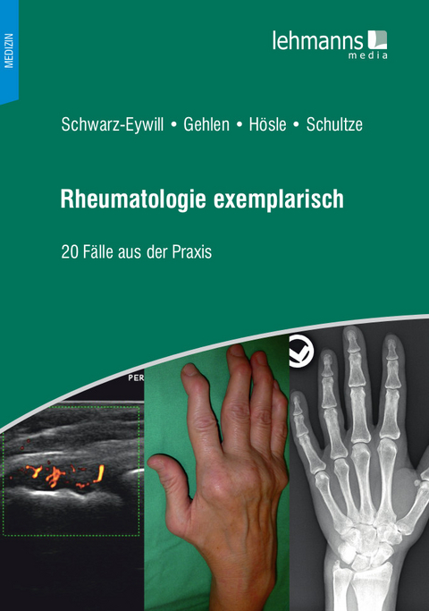 Rheumatologie exemplarisch - Michael Schwarz-Eywill, Martin Gehlen, Rosmarie Hösle, Mareen Schultze