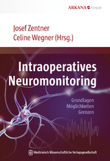 Intraoperatives Neuromonitoring - Josef Zentner, Celine Wegner