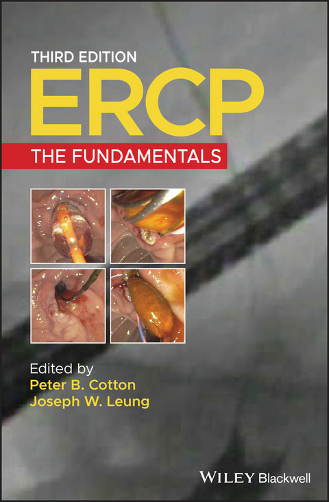 ERCP - 