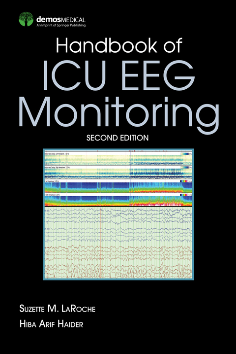 Handbook of ICU EEG Monitoring - 