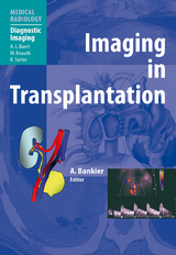 Imaging in Transplantation - 