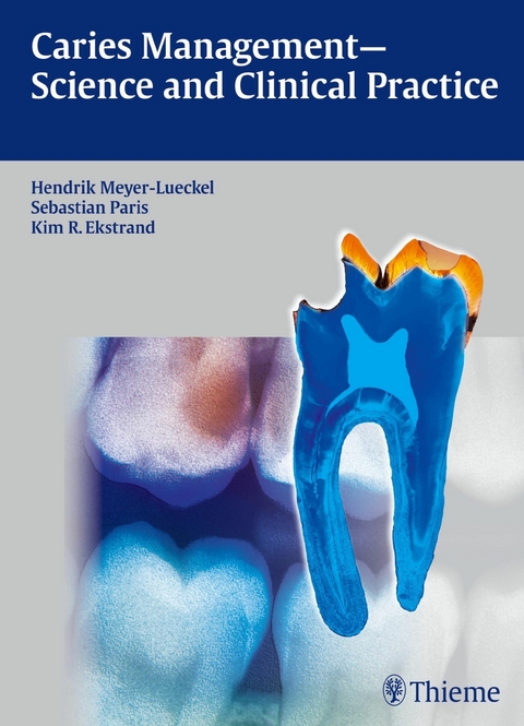 Caries Management - Science and Clinical Practice - 