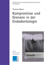 Kompromisse und Grenzen in der Endodontologie - Thomas Mayer