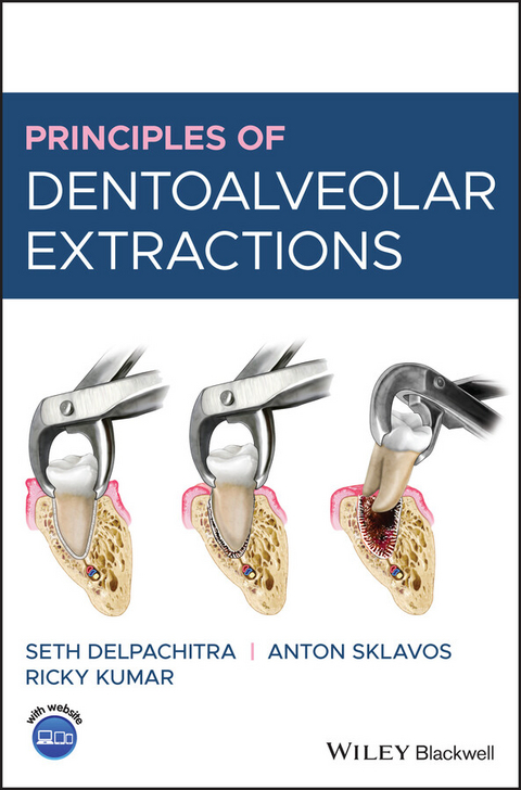 Principles of Dentoalveolar Extractions -  Seth Delpachitra,  Ricky Kumar,  Anton Sklavos
