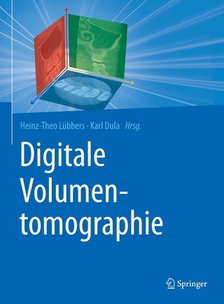 Digitale Volumentomographie - Heinz-Theo Lübbers; Karl Dula