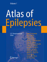Atlas of Epilepsies - 