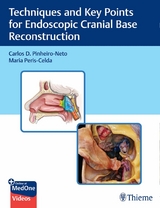 Techniques and Key Points for Endoscopic Cranial Base Reconstruction - Carlos Pinheiro-Neto, Maria Peris-Celda