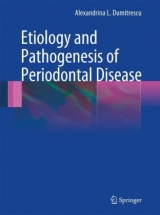Etiology and Pathogenesis of Periodontal Disease - Alexandrina L Dumitrescu