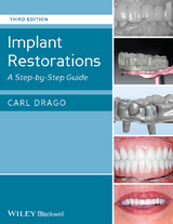 Implant Restorations -  Carl Drago