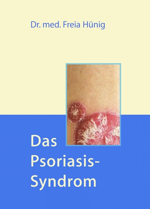 Das Psoriasis-Syndrom - Dr. Freia Hünig