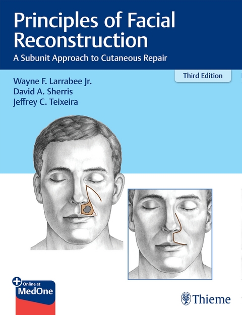 Principles of Facial Reconstruction - Wayne F. Larrabee, David A. Sherris, Jeffrey Teixeira
