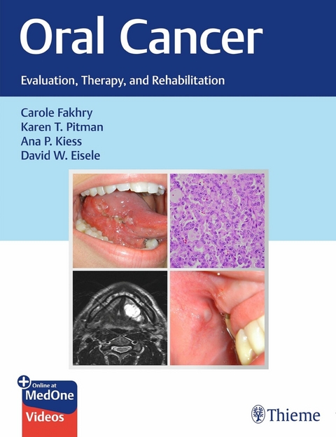 Oral Cancer - Carole Fakhry, Karen T. Pitman, Ana P. Kiess, David W. Eisele