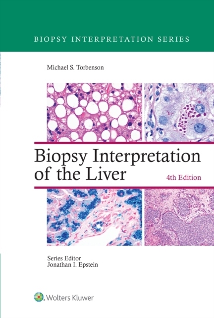 Biopsy Interpretation of the Liver -  Michael Torbenson