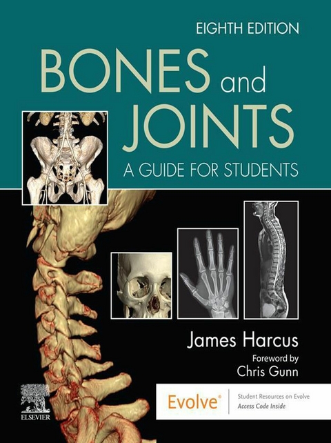 Bones and Joints - E-Book -  James Harcus