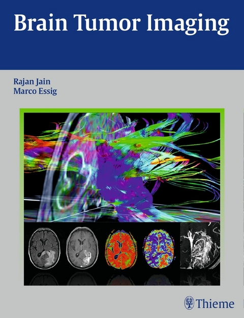 Brain Tumor Imaging - Rajan Jain, Marco Essig