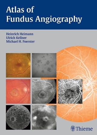 Atlas of Fundus Angiography - Heinrich Heimann; Michael H. Foerster; Ulrich Kellner