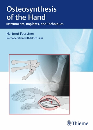 Osteosynthesis of the Hand - Hartmut Förstner