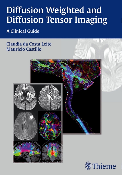 Diffusion Weighted and Diffusion Tensor Imaging - 