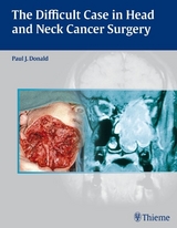 The Difficult Case in Head and Neck Cancer Surgery - Paul J. Donald