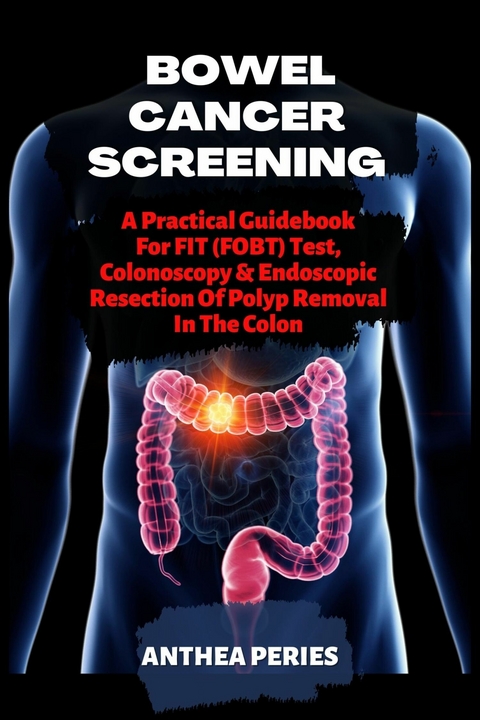 Bowel Cancer Screening -  Anthea Peries