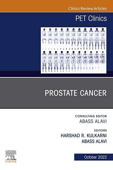 Prostate Cancer, An Issue of PET Clinics, E-Book - 
