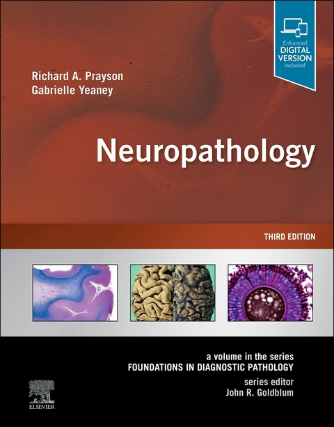 Neuropathology - 