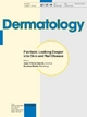 Psoriasis: Looking Deeper into Skin and Nail Disease - J.-H. Saurat; K. Reich