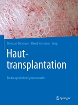 Hauttransplantation - 