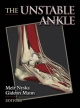 Unstable Ankle